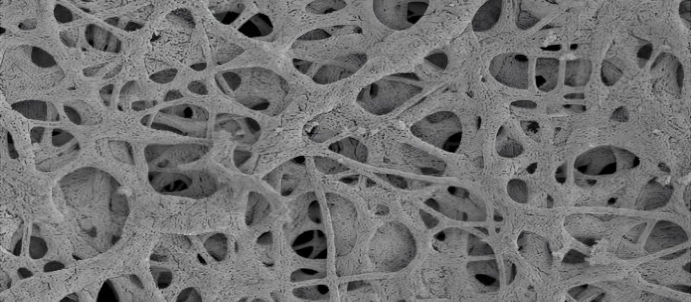 MMO Titanium Anode Structure | NAVI Titanium MMO Titanium Anode Structure | NAVI Titanium